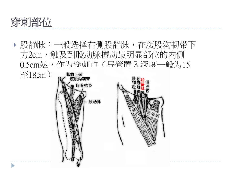 深静脉穿刺护理PPT