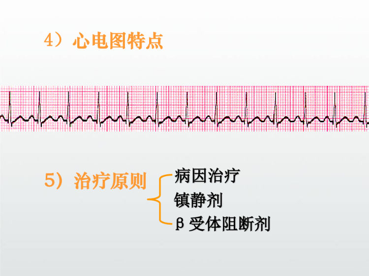 心律失常护理PPT