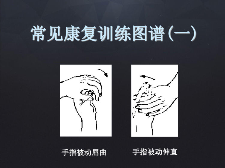 手外伤康复护理PPT