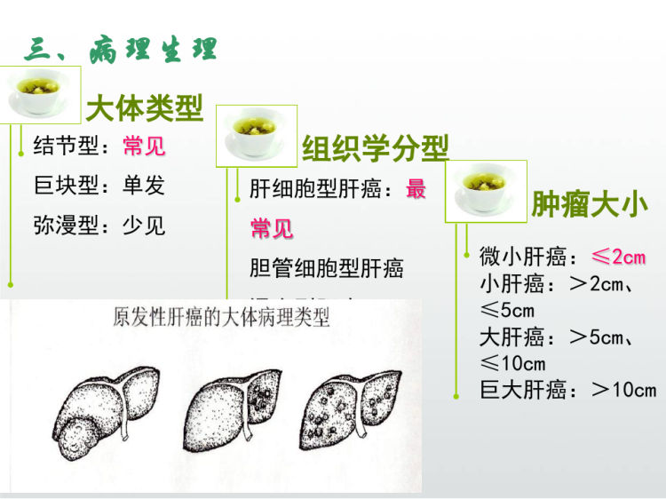 原发性肝癌护理PPT