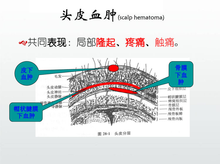 重症颅脑损伤病人监护护理PPT