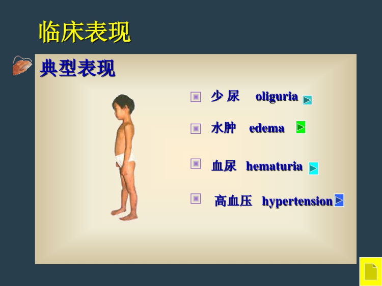 急性肾小球肾炎诊断治疗PPT