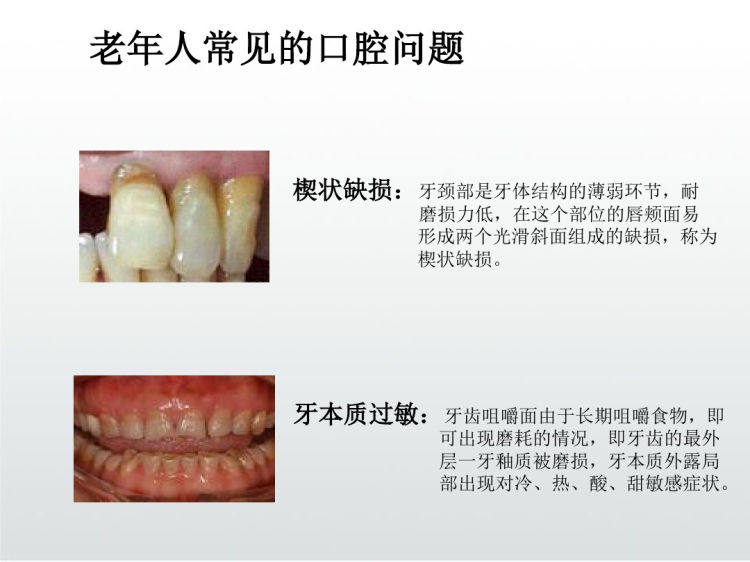 老年人口腔健康护理PPT