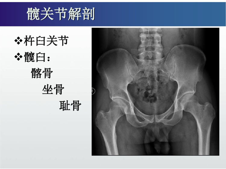 髋关节常见病磁共振影像诊断PPT