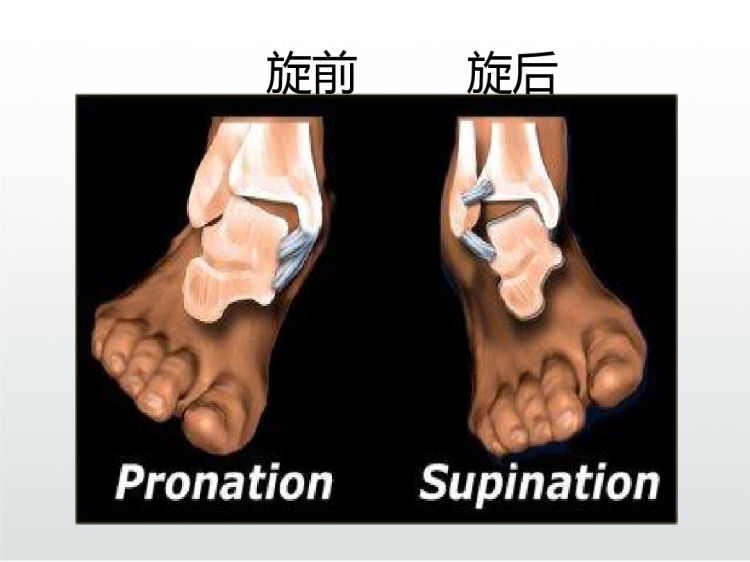 踝关节骨折分型PPT