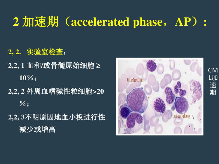 慢性粒细胞白血病PPT