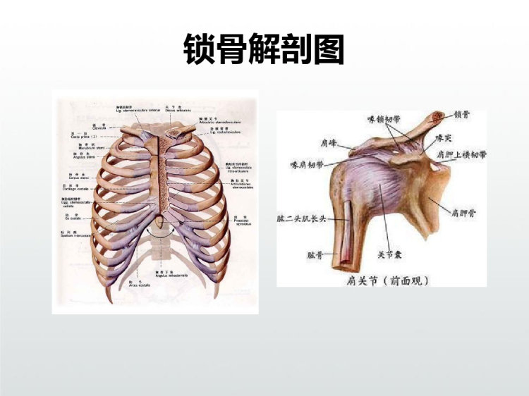 锁骨骨折护理查房PPT