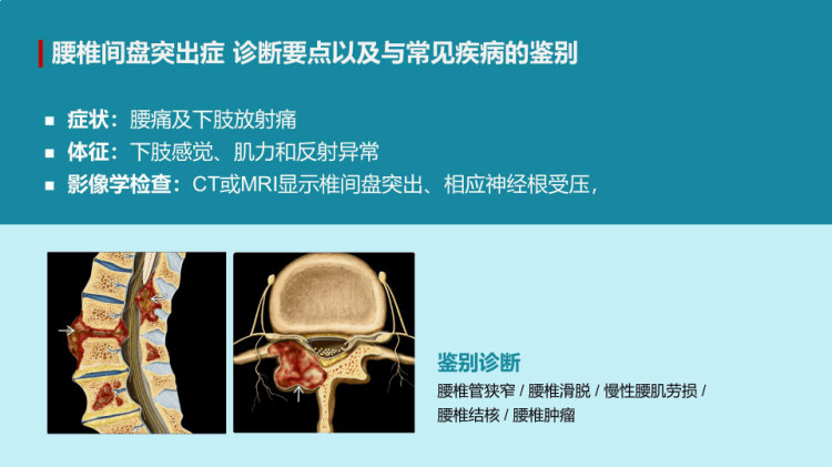 办公室常见颈腰椎疾病预防及养护PPT