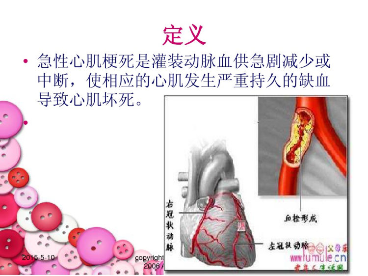 急性心肌梗死护理PPT