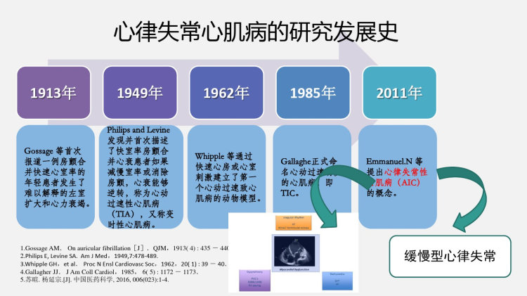 心律失常性心肌病PPT