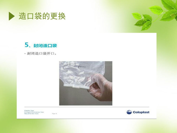 肠造口护理PPT