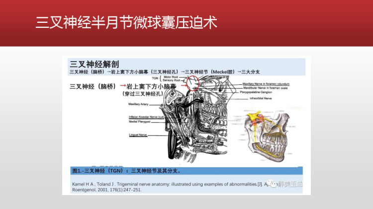 三叉神经阻滞PPT