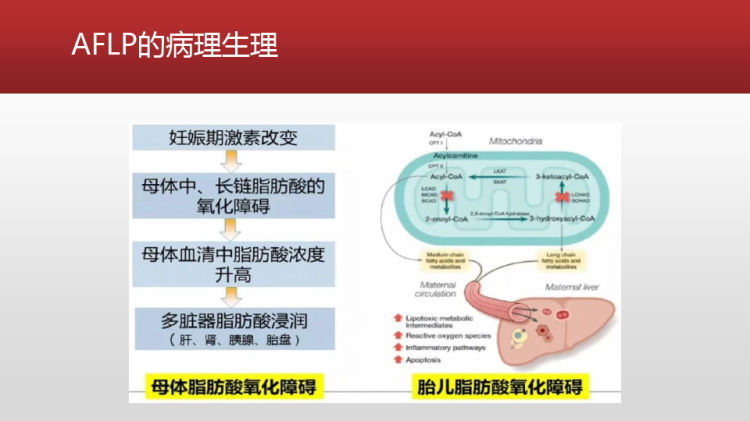 妊娠期急性脂肪肝行剖宫产病人PPT