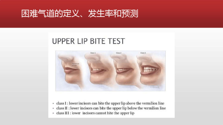 困难气道管理PPT