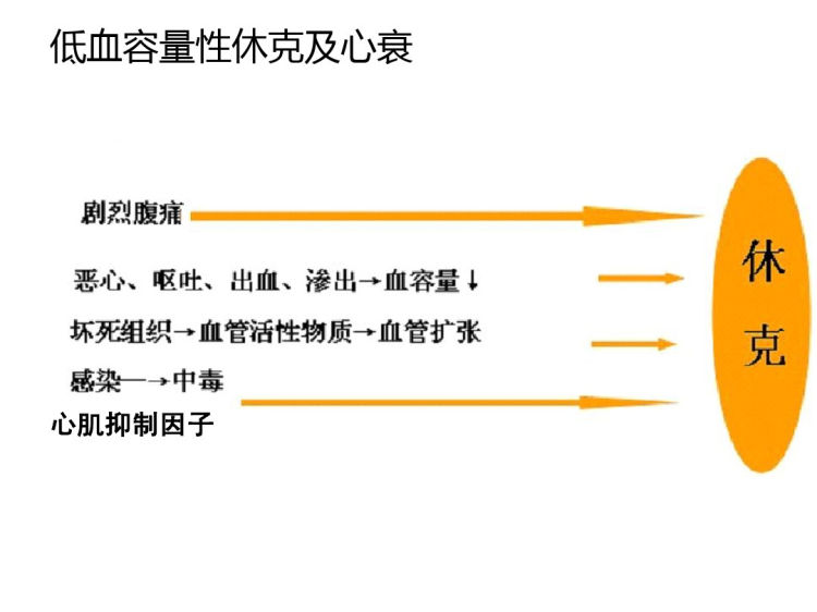 急性重症胰腺炎诊治要点PPT