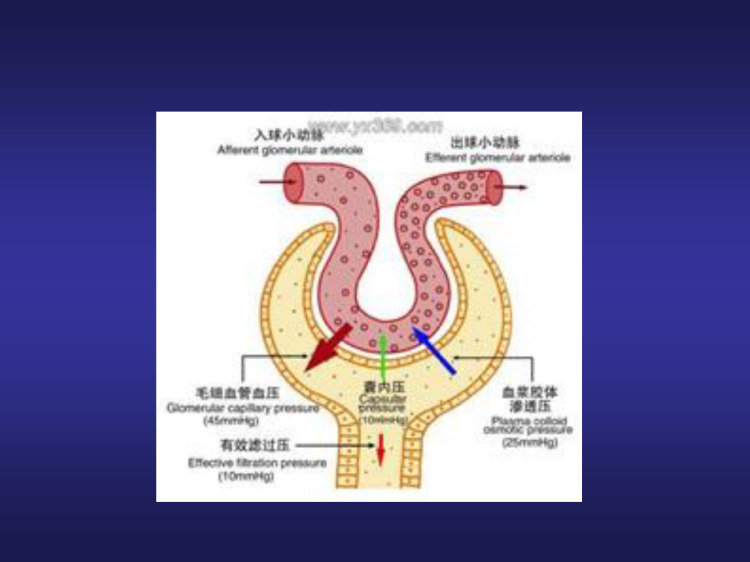 肾病综合征护理PPT