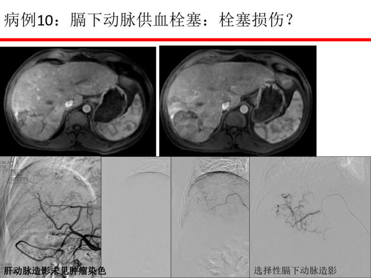 载药微球经验分享PPT