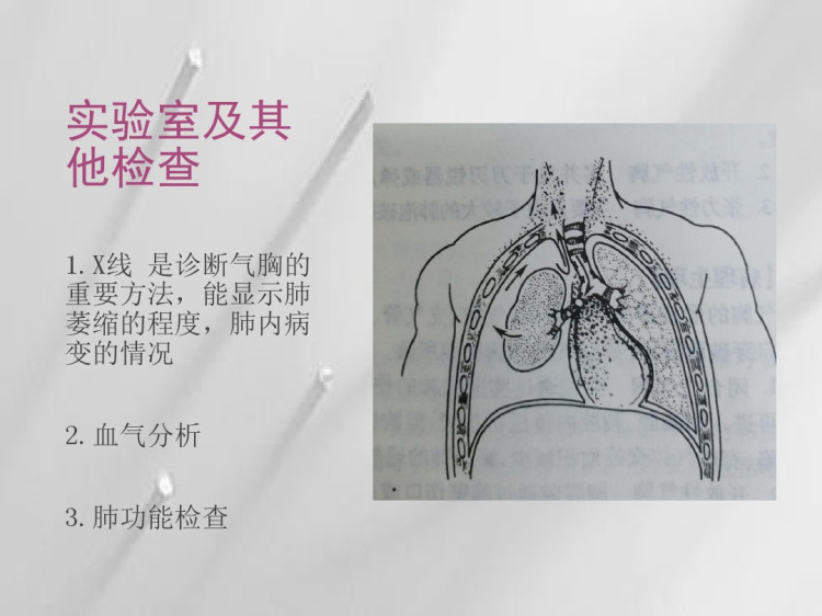 气胸及血胸病人的急救PPT