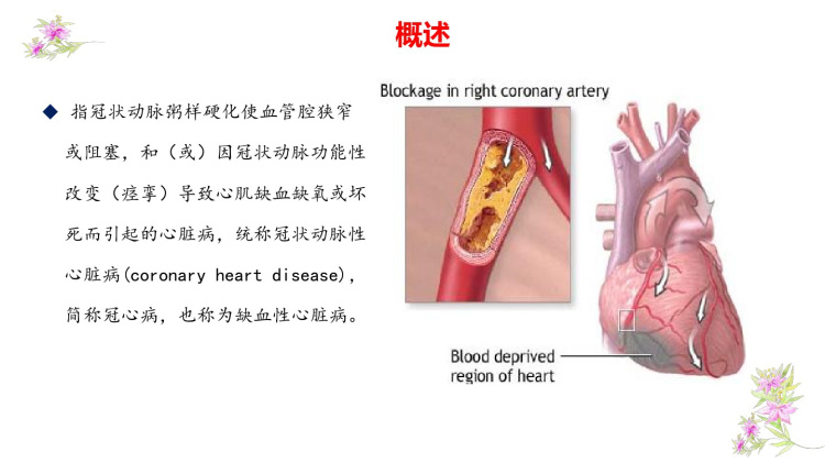 冠心病冠脉搭桥术护理查房PPT