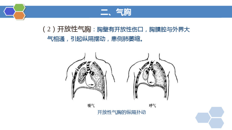 胸部损伤病人的护理PPT