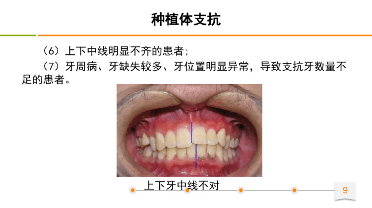 口腔正畸学之种植体支抗PPT