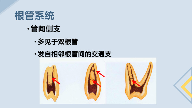 口腔临床诊疗基本操作技术之根管治疗恒牙髓腔应用解剖PPT