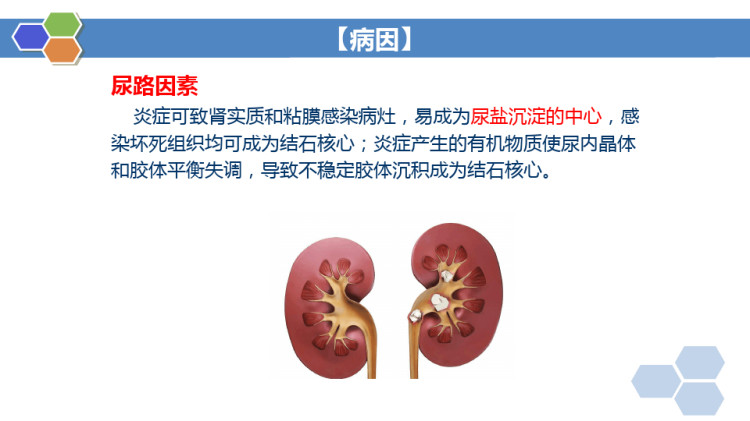 尿石症病人的护理PPT