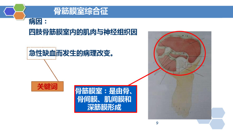 外科护理之骨折病人的护理评估PPT