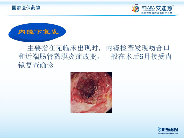 克罗恩术后复发的预防及治疗PPT