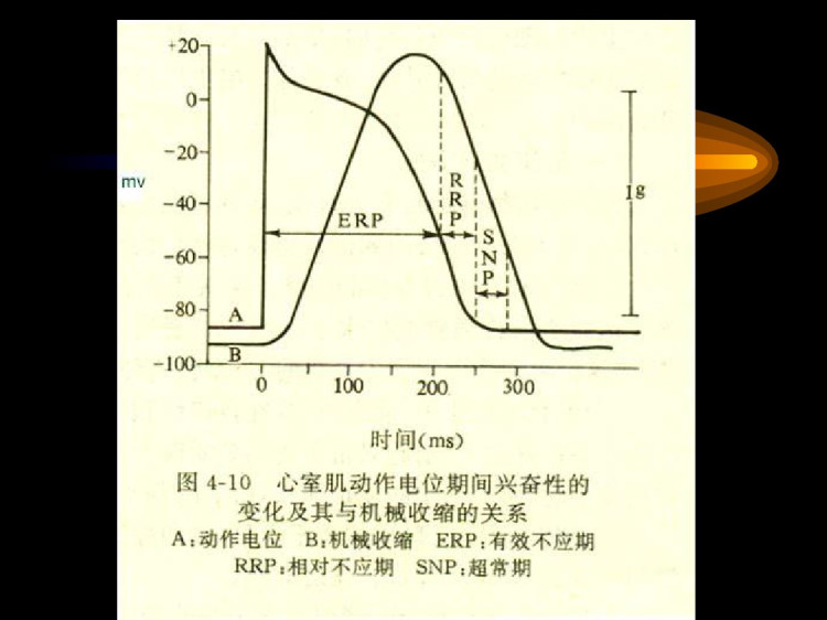 心律失常发生机理培训PPT