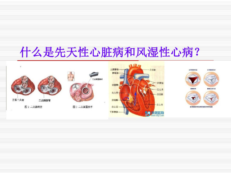 先天性心脏及风湿性心脏病PPT