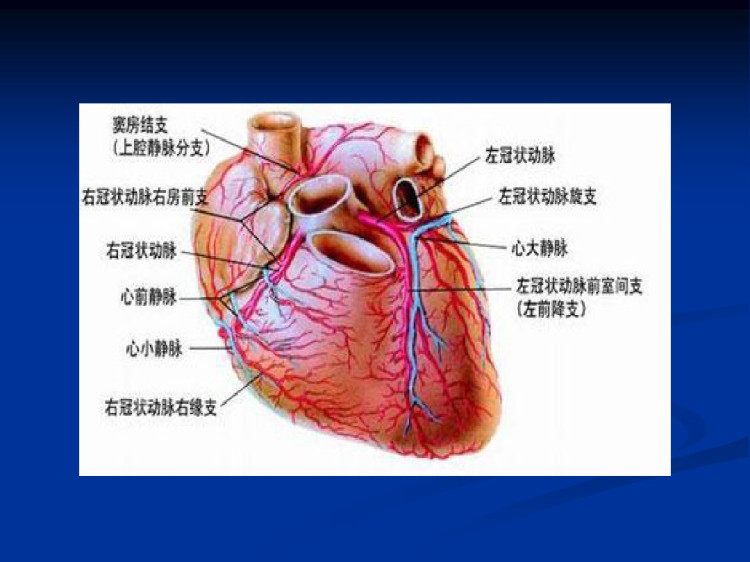 合并冠心病非心脏手术麻醉课件PPT