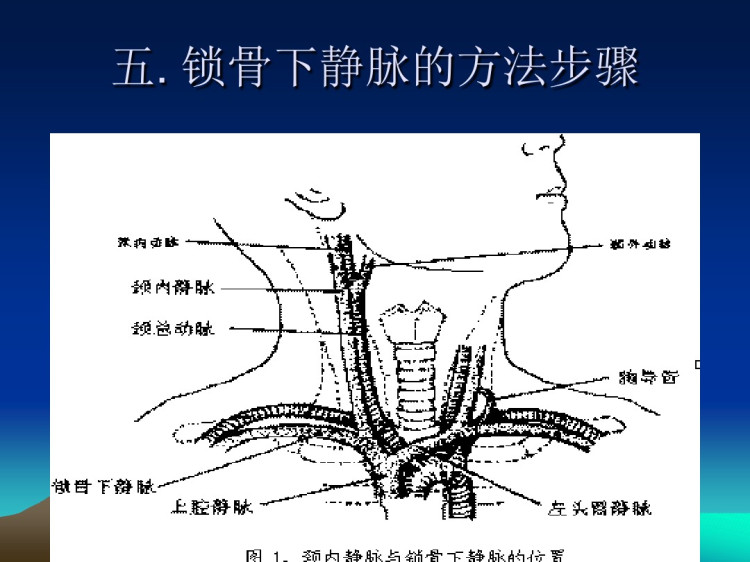 已上传中心静脉置管术在临床的应用PPT