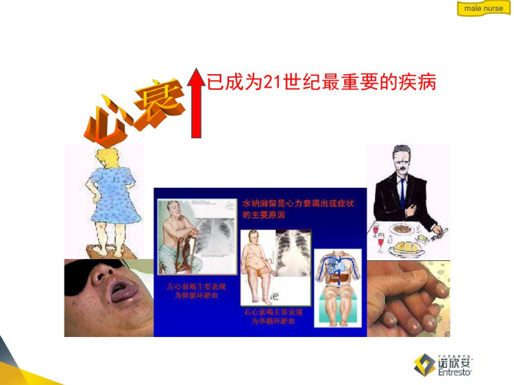 诺欣妥在心衰PPT