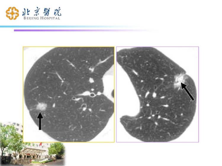 胸外科特殊检查方法PPT