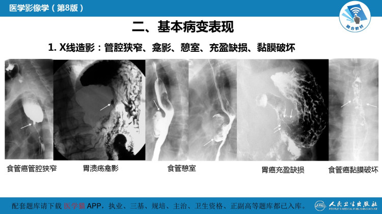 医学影像学(食管与胃肠道PPT