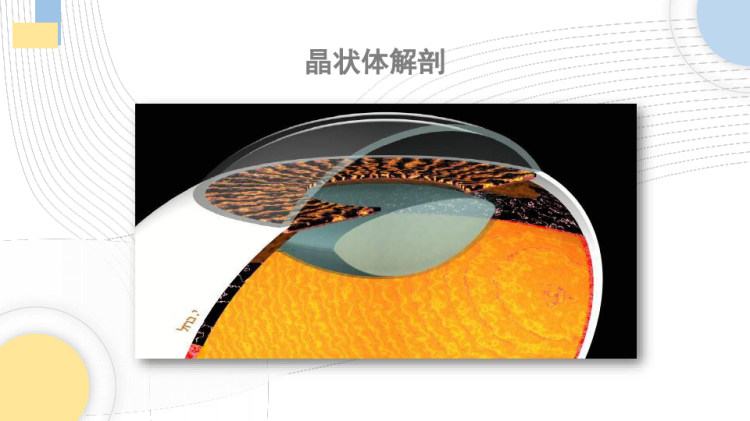 白内障护理查房PPT