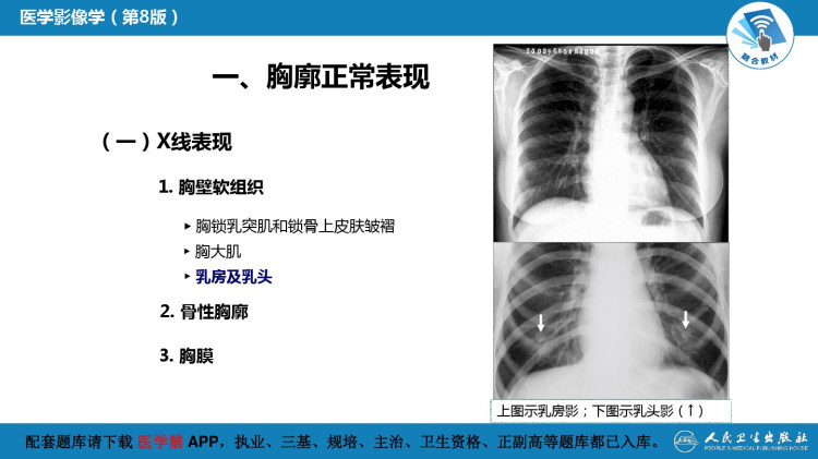 呼吸系统正常影像表现PPT