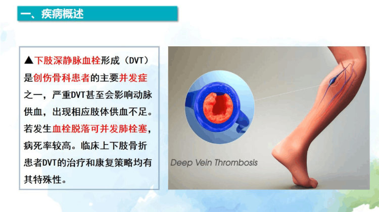 围术期下肢静脉血栓诊断及防治专家共识2022解读PPT