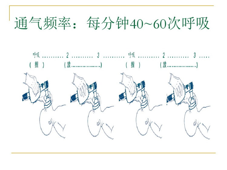 新生儿复苏个案查房PPT