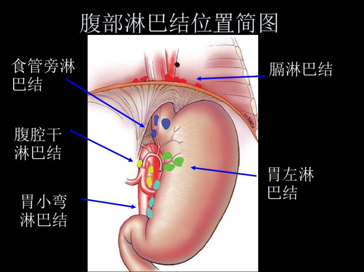 腹部淋巴结PPT