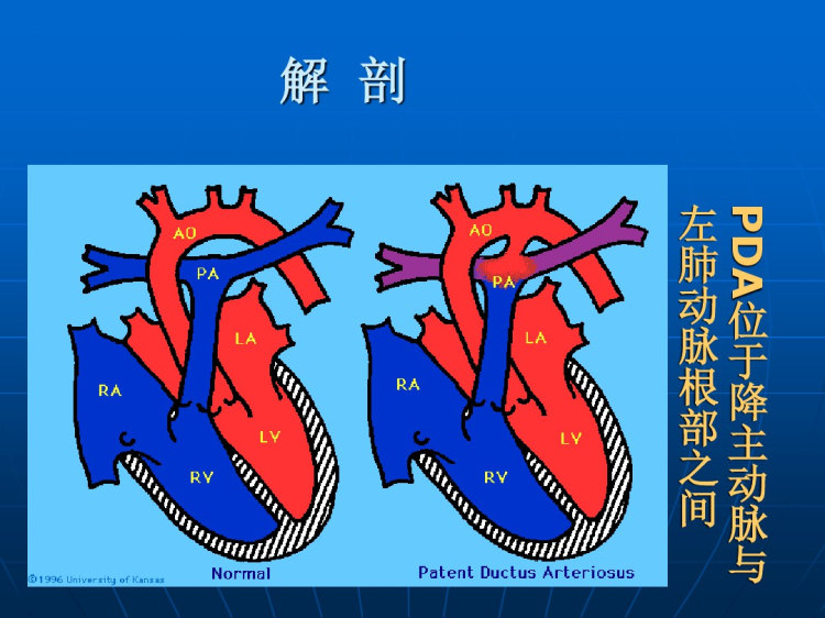 心脏外科PPT