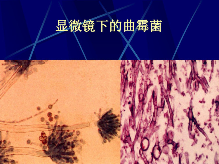 呼吸系统影像诊断学PPT