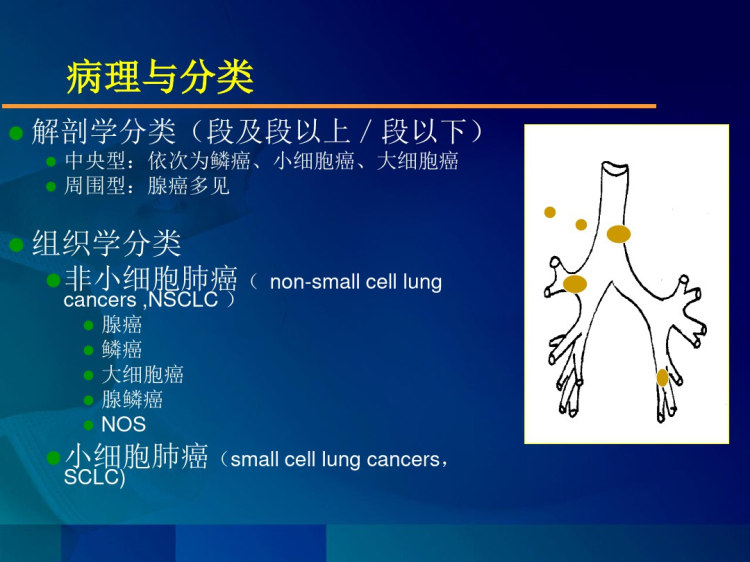 肺癌PPT