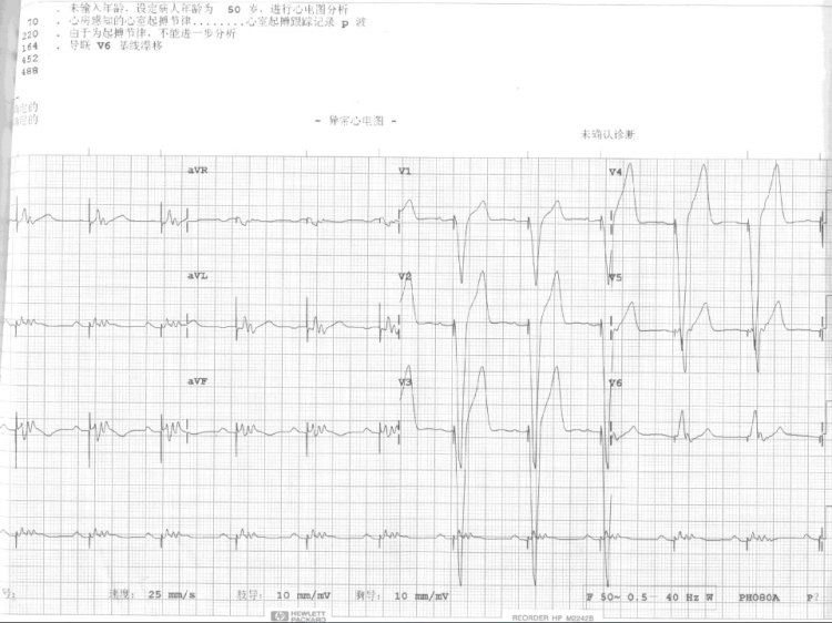 临床内科病例PPT