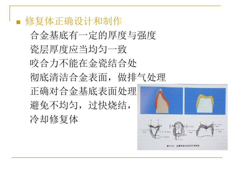 烤瓷合金PPT