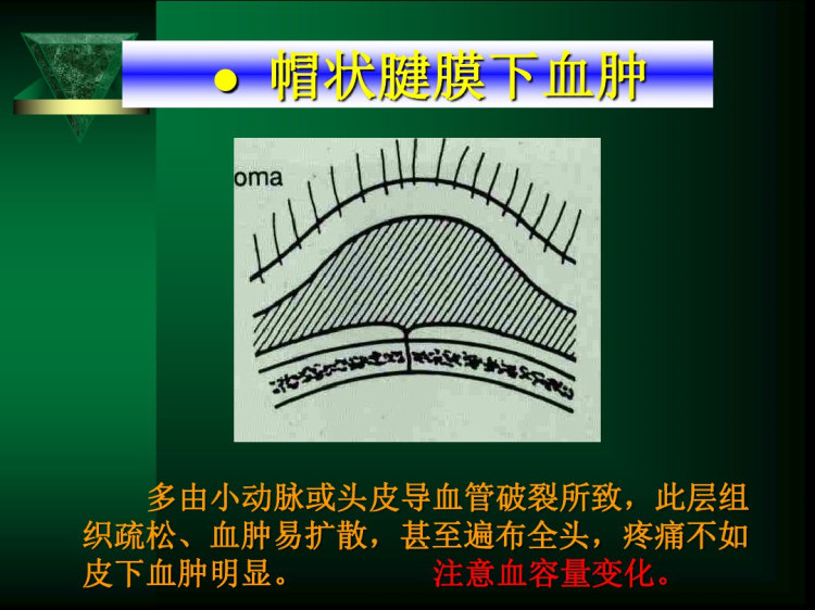 颅脑外伤PPT