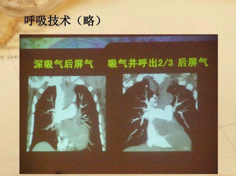 第十八次全国影像技术大会CT学组会后总结PPT