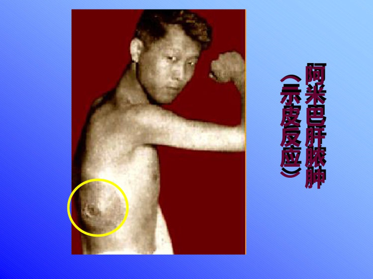 溶组织内阿米巴PPT