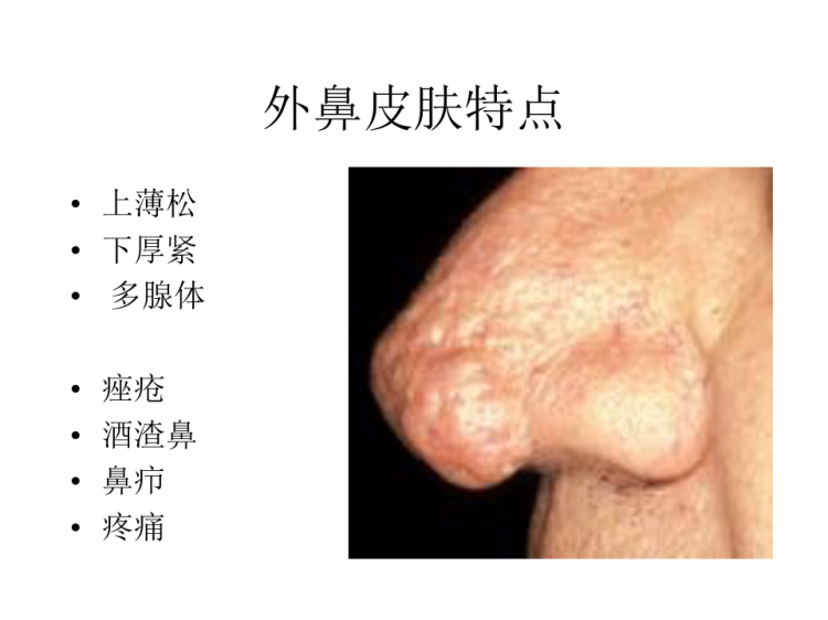 鼻与鼻窦解剖PPT